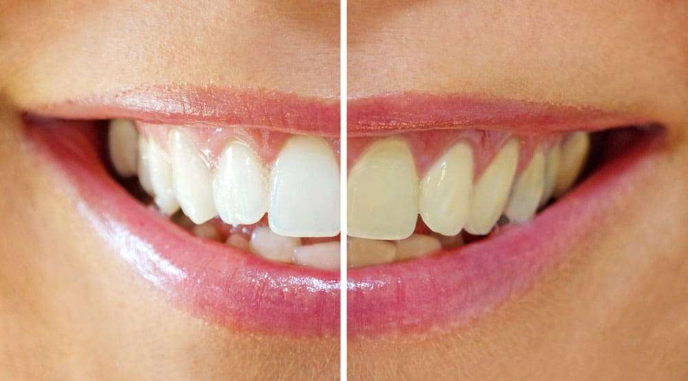 cosmetic-dentistry ballarat