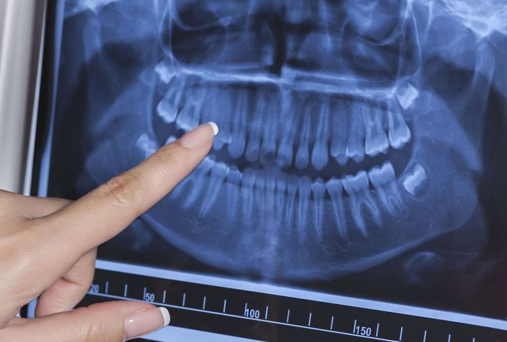 debunking-radiographs