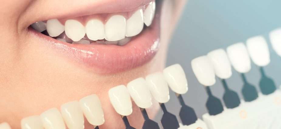 Cosmetic Dentistry Ballarat by Lydiard St Dental Cosmetic Dentistry Ballarat by Lydiard St Dental